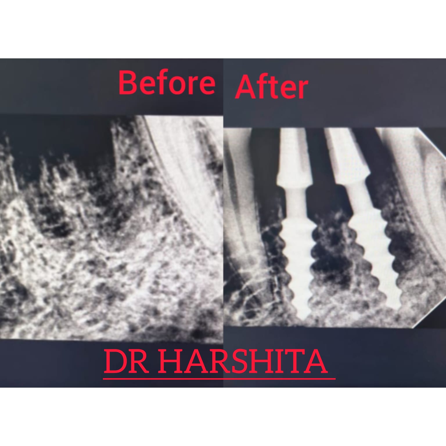 Before & After - Skin Treatment